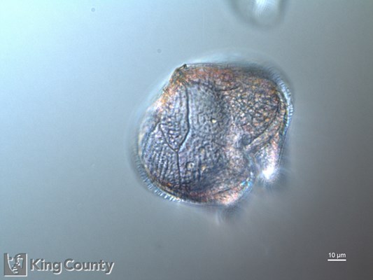Photo of Protoperidinium conicum/Protoperidinium leonis